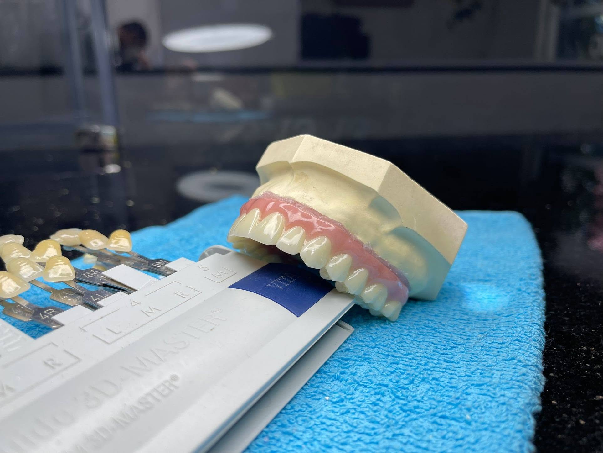 Đối màu răng sứ theo bảng VITA 3D-MASTER tại Nguyễn Long Lab